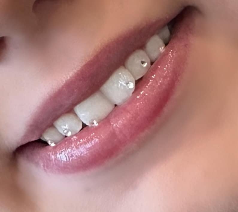 Hammaskoru Verkkokoulutus (Tooth Fairy) - Image 6