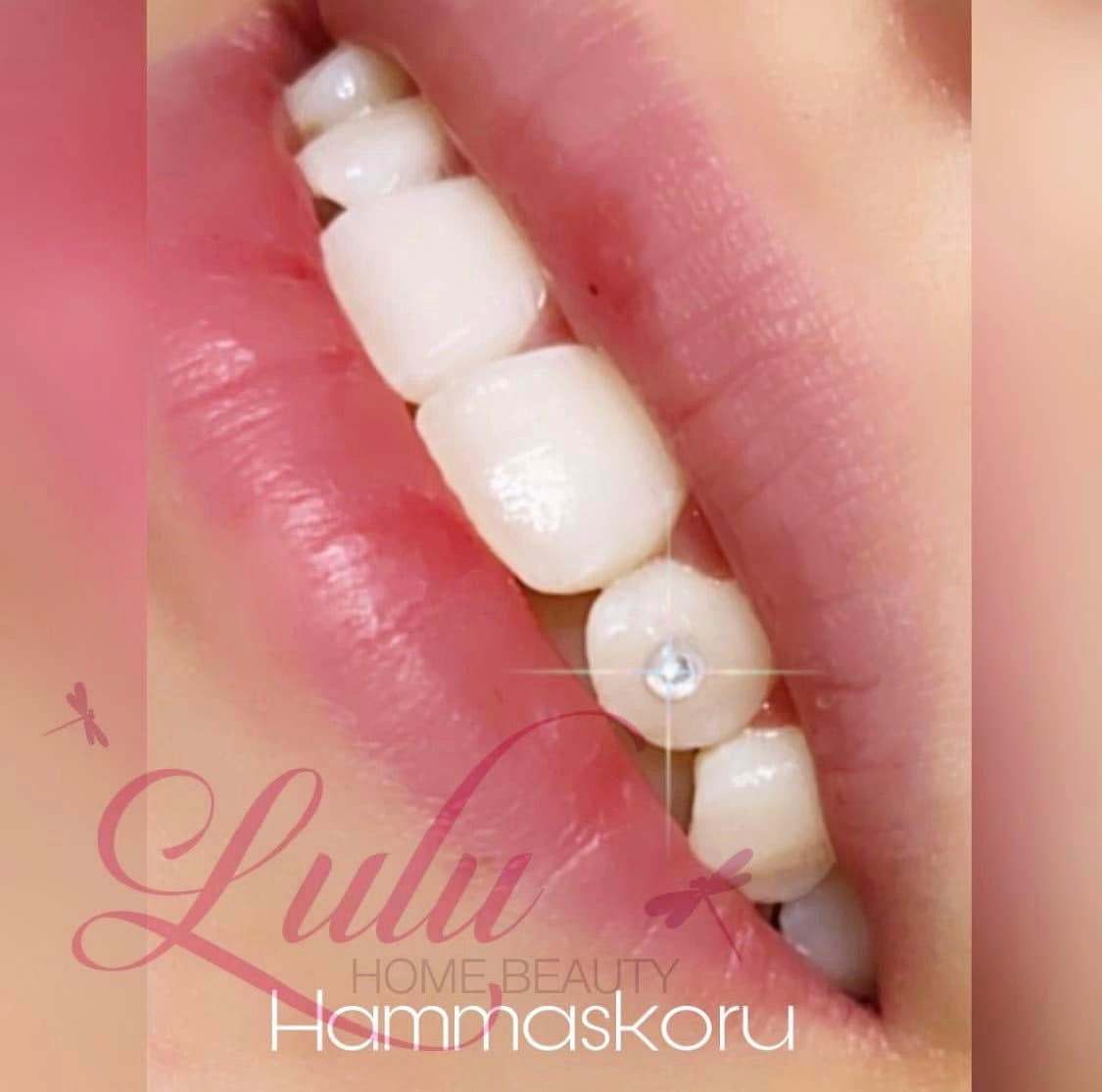 Hammaskoru hampaassa - koulutuspaketti